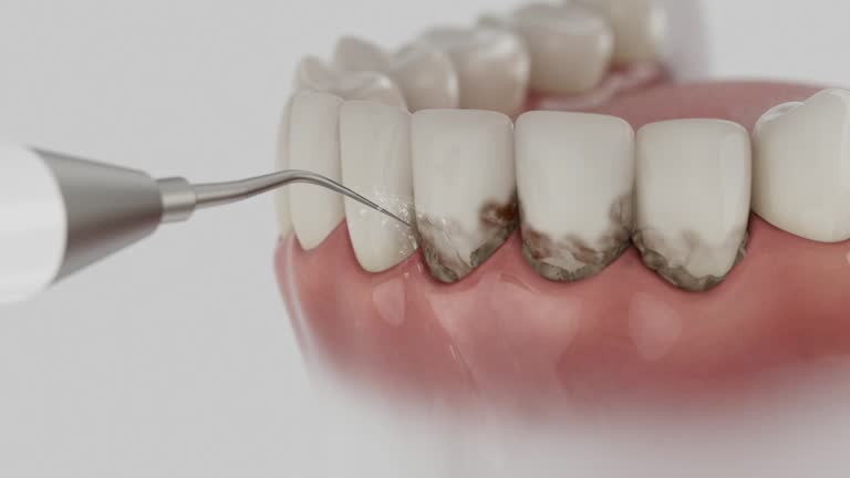 Reliable Emergency Dentist contractor in Lemmon, SD by Smile Center Dentistry